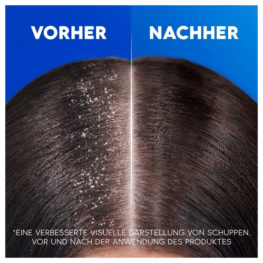 Bild: head & shoulders For Men Anti-Schuppen-Shampoo 