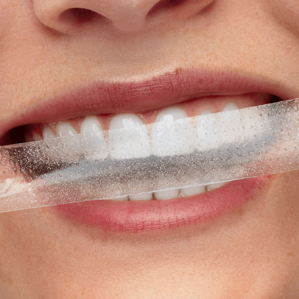 Bild: Smilepen Night Whitening Strips 