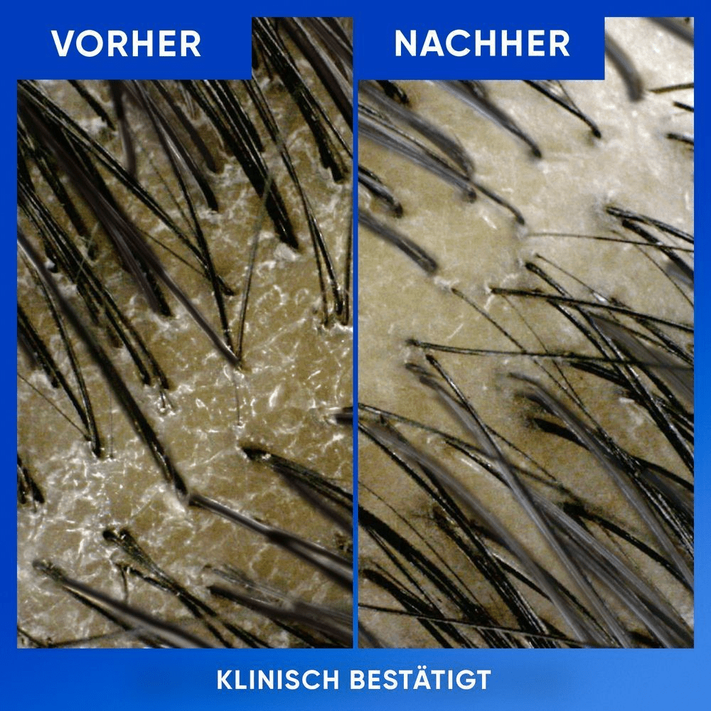 Bild: head & shoulders Clarify & Shine Anti-Schuppen-Shampoo